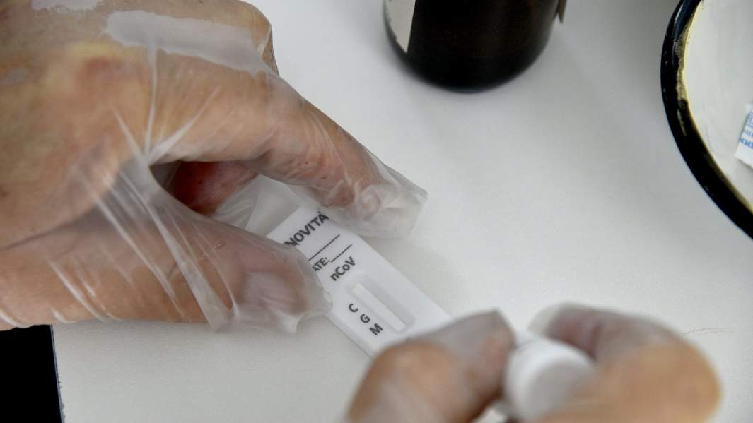 вирус ковид тест