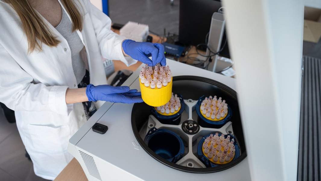 Антитело как улика: колебания гормонов влияют на результаты ПЦР-теста