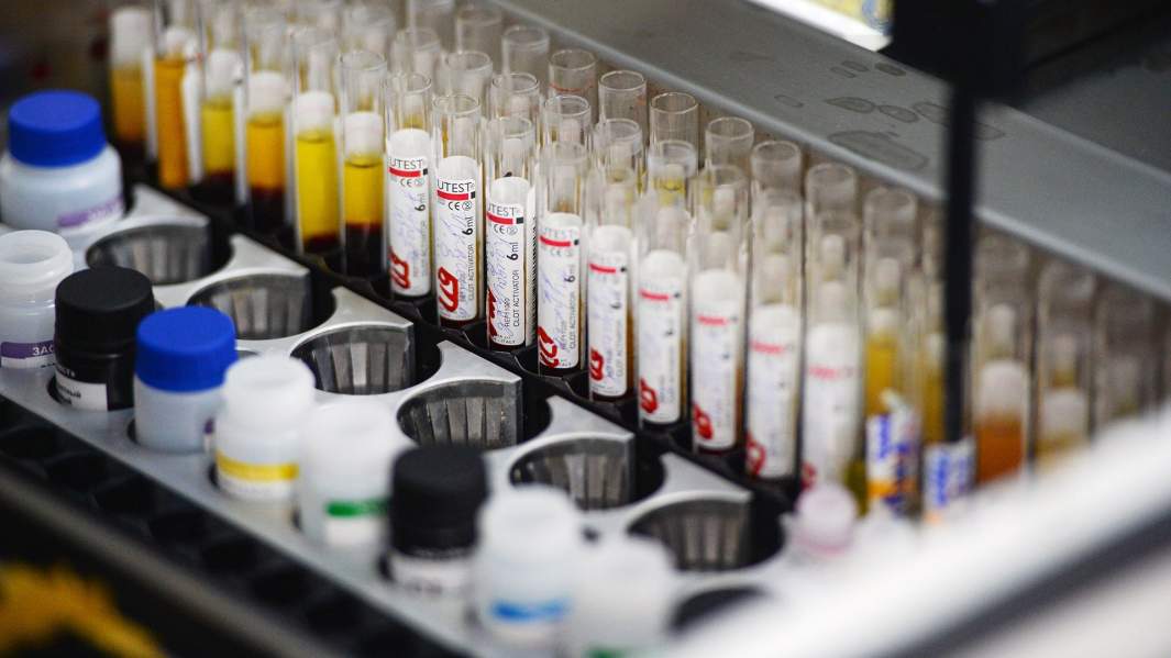 Лаборатория иммуноферментных исследований, где проходит исследование крови на инфекции