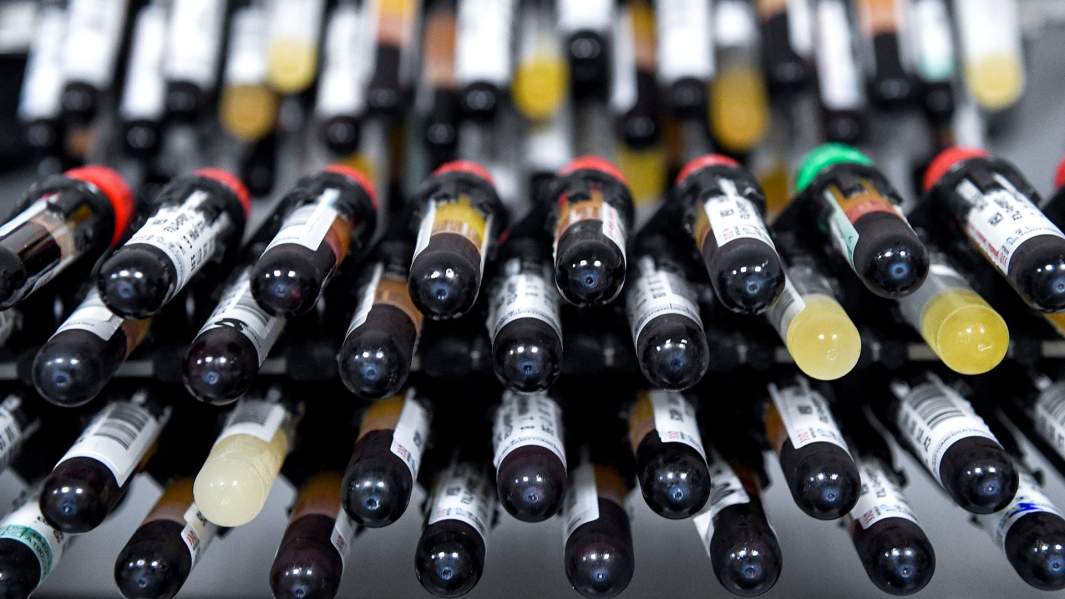 Пробирки с биоматериалом в лабораторном комплексе медицинской компании