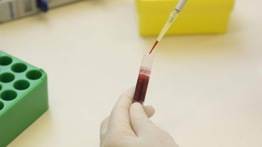 Природные разносчики: как грызуны распространяют лихорадку по России