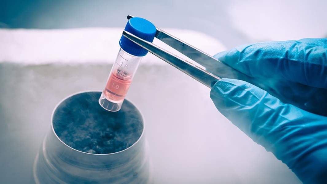 Стволовые клетки