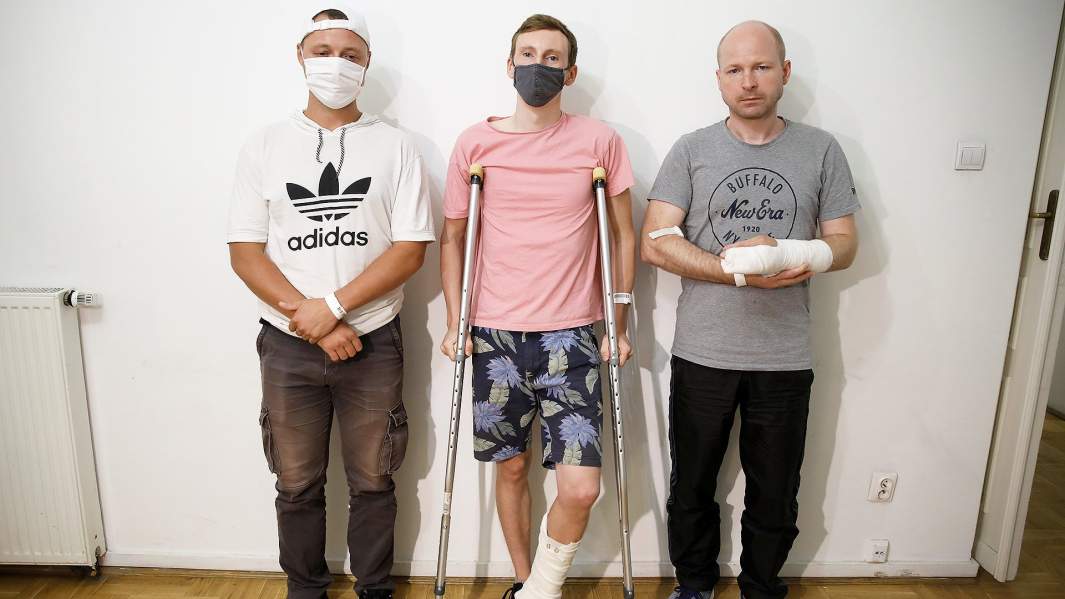 Пострадавшие белорусские протестующие, получившие бесплатную медицинскую помощь в Польше