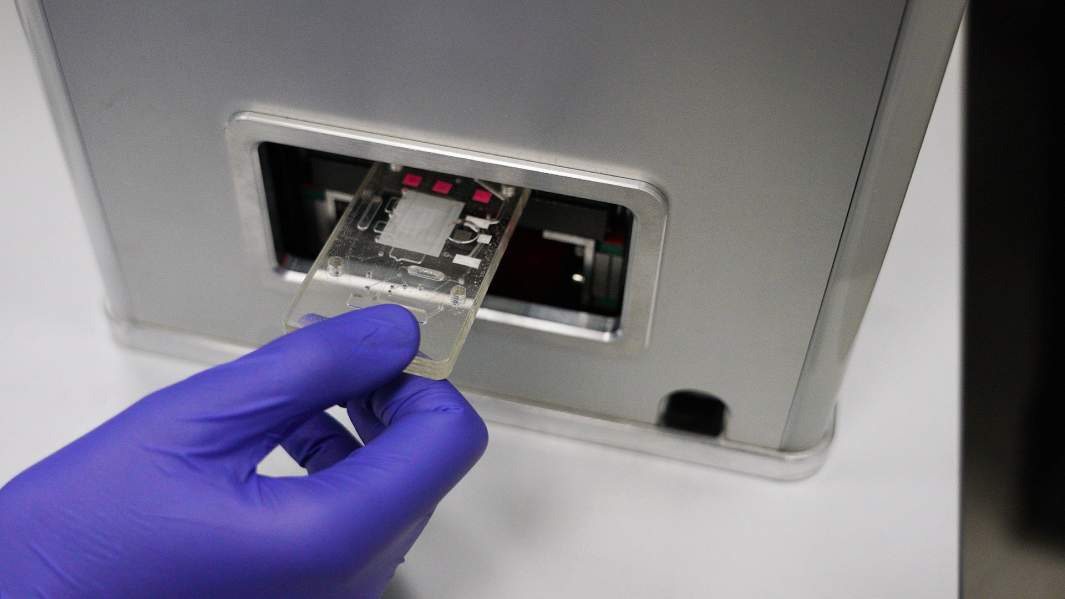 коронавирус тест