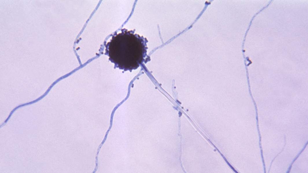 Aspergillus