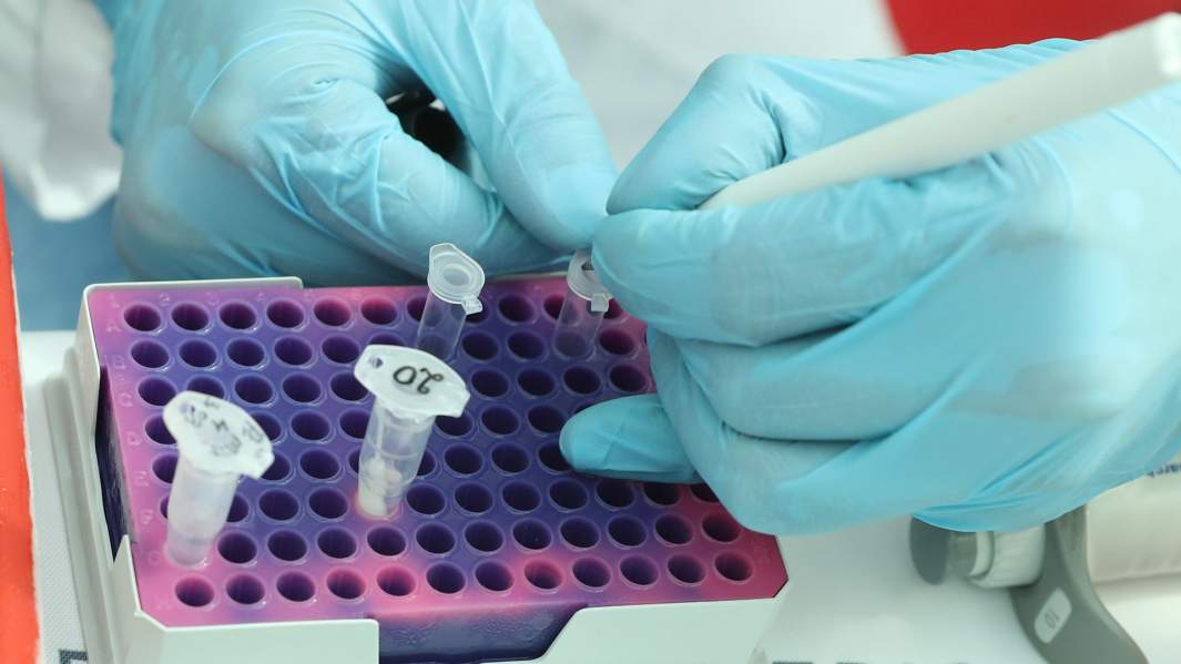 Коечная недостаточность: помогут ли новые меры разгрузить стационары