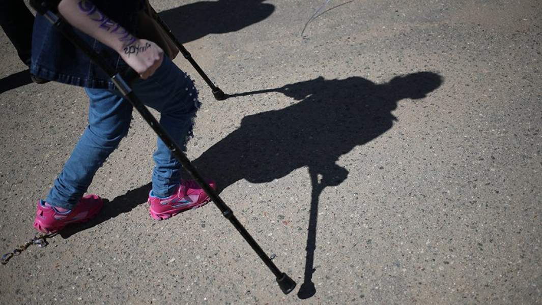 Девушка с костылями 