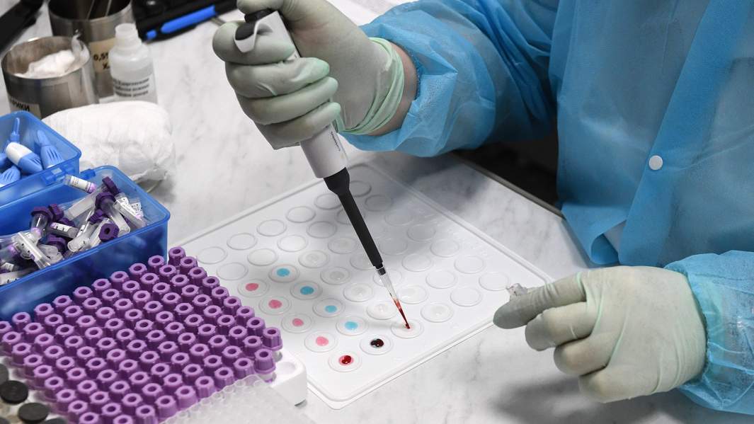 Анализ по определению группы крови