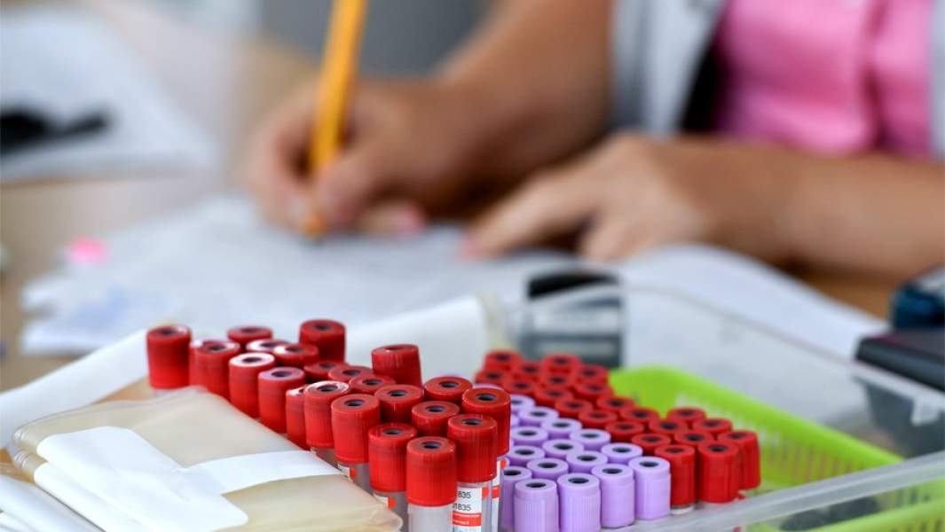 исследование