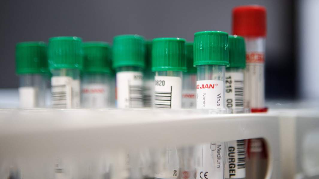 Вирус в тумане: так ли опасен новый «британский» штамм SARS-CoV-2