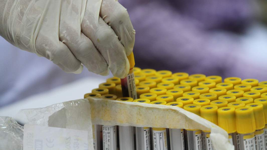 Тромб среди ясного неба: почему страны ЕС отказываются от вакцины AstraZeneca