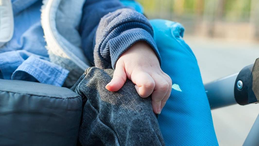 Рука ребенка с ДЦП