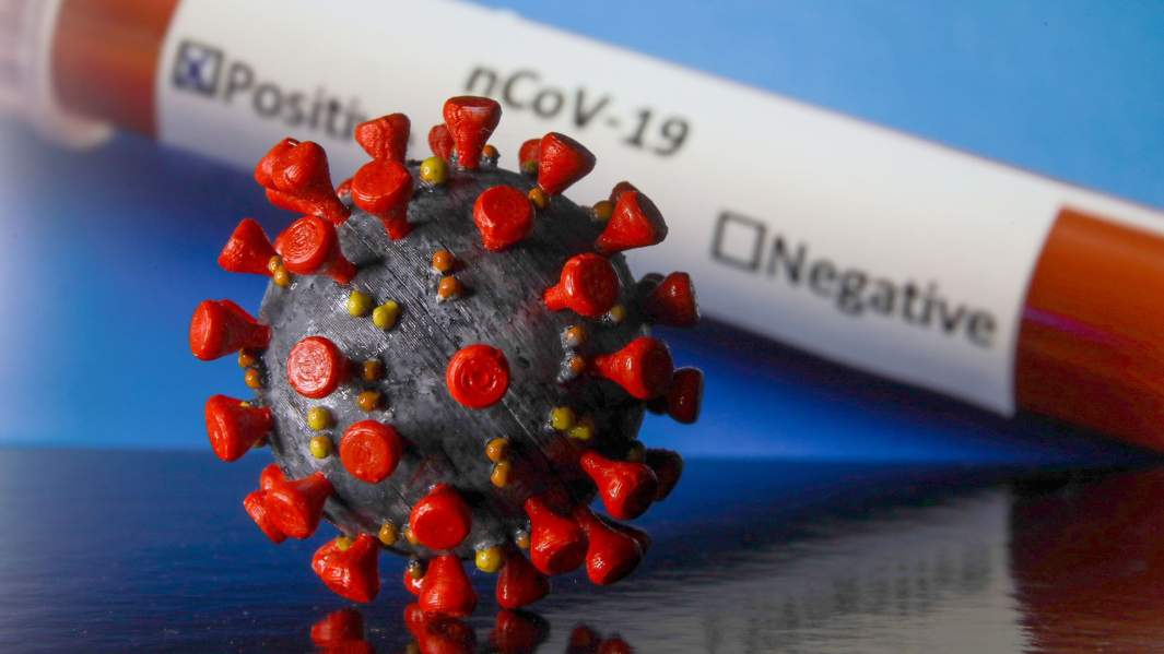вирус ковид тест