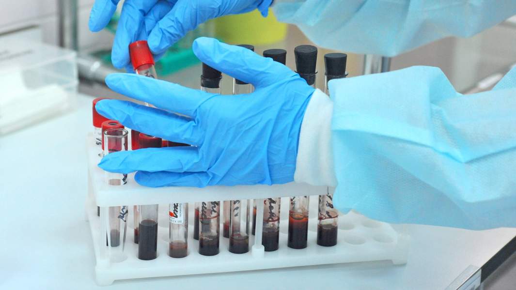Лаборант иммунологического отдела Центра по профилактике и борьбе со СПИДом в городе Тамбове принимает биологический материал (кровь) для дальнейшего исследования