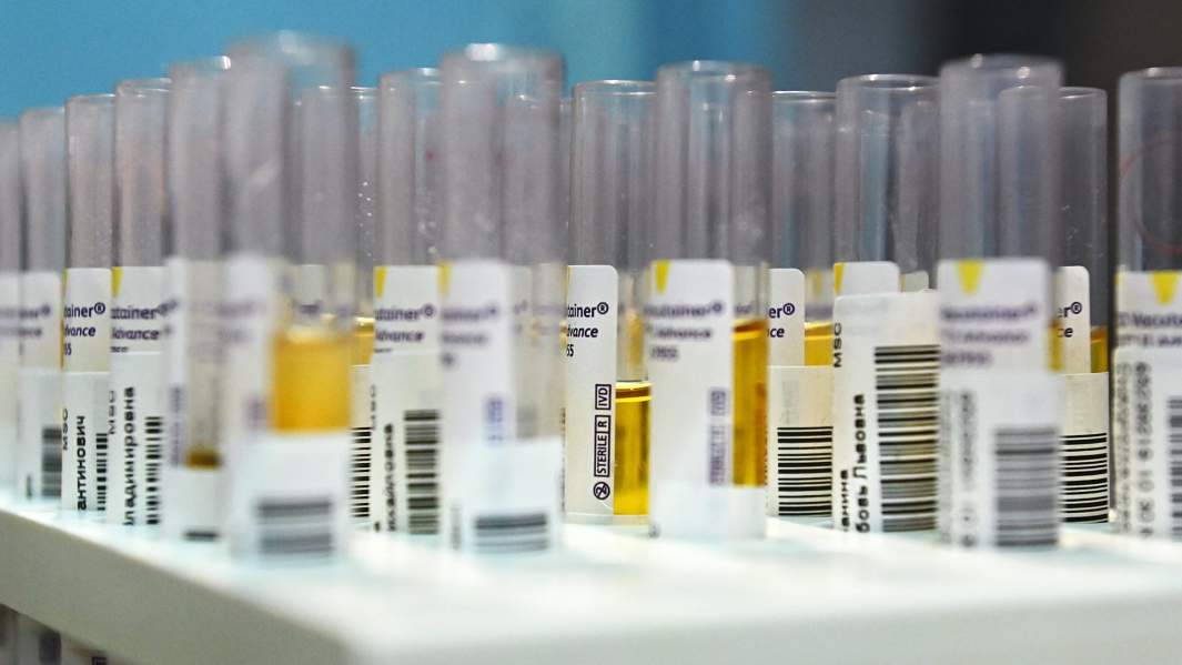 пробирки анализы