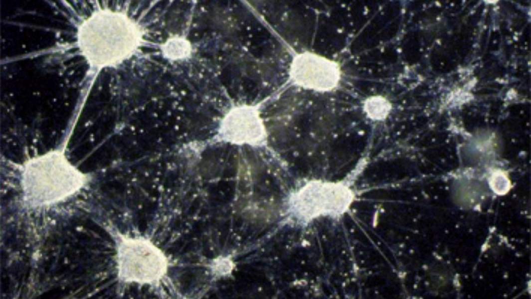 Изображение дофаминовых нейронов