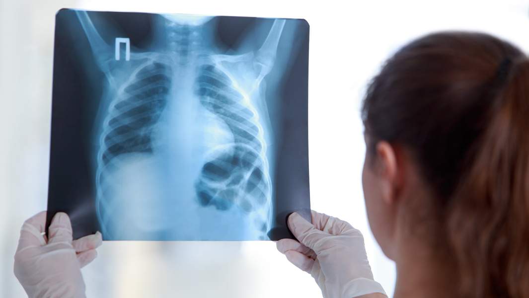 врач осматривает рентген легких