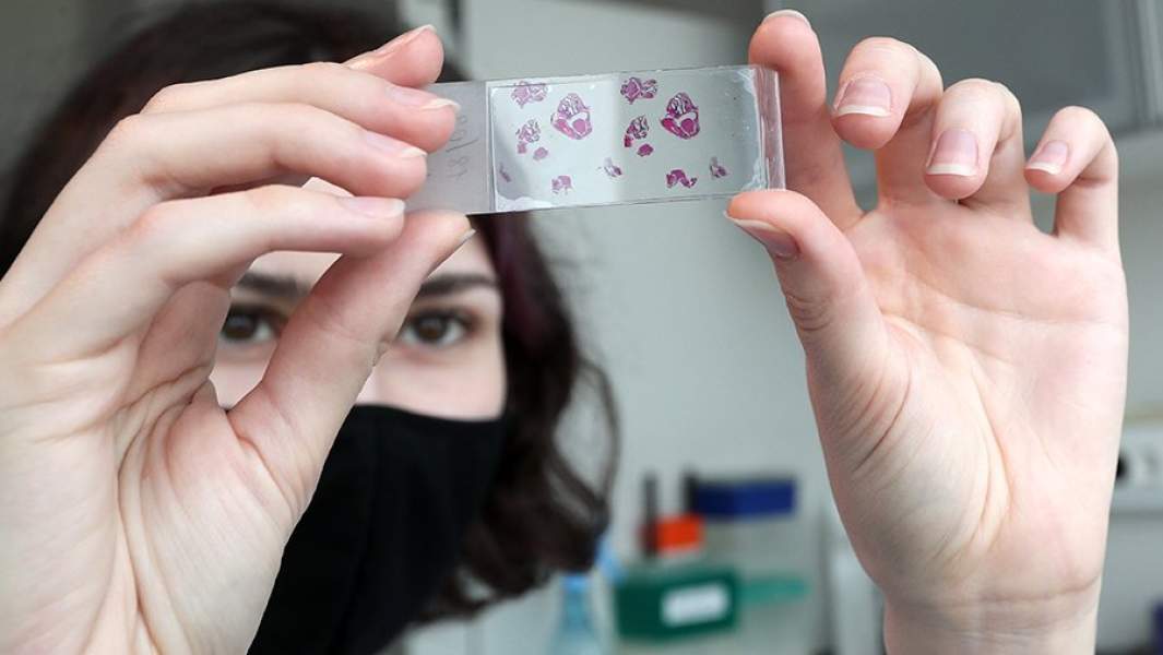 Сотрудница рассматривает клетки ткани легких мышей в лаборатории научного центра «Институт иммунологии» ФМБА России