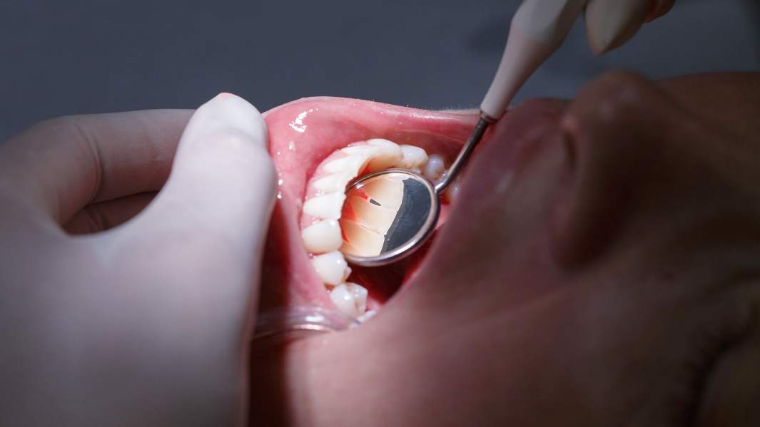 стоматолог зубы доктор