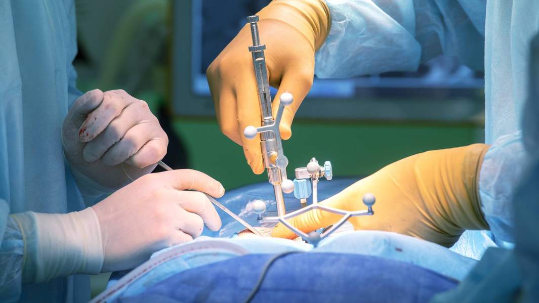 хирург операция