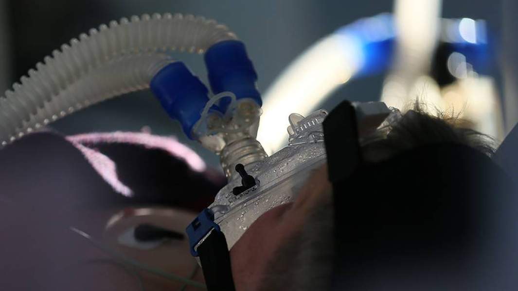 пациент на аппарате ИВЛ