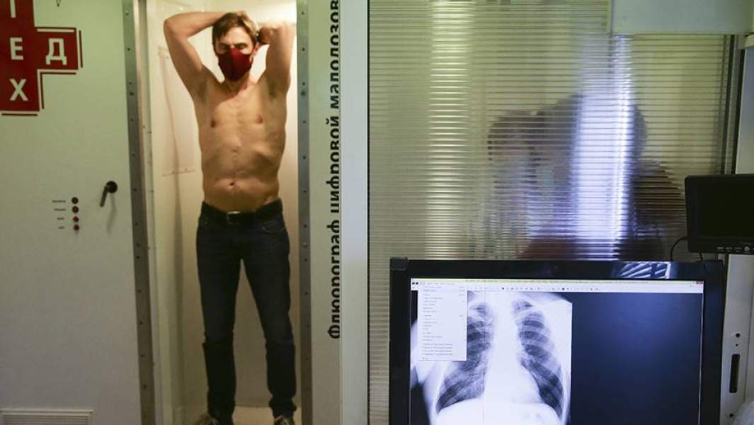 Пациент во время флюорографии в рамках диспансеризации