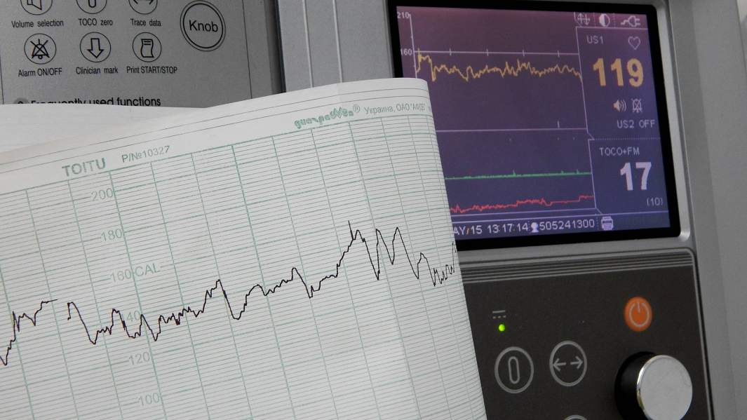 график сердечного ритма