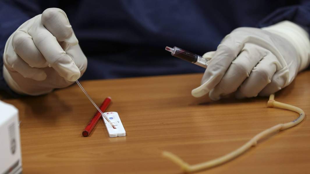 тест на коронавирус