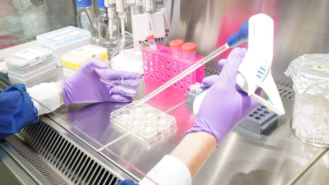 Наплевать и лечить: ученые предскажут тяжесть COVID-19 по слюне