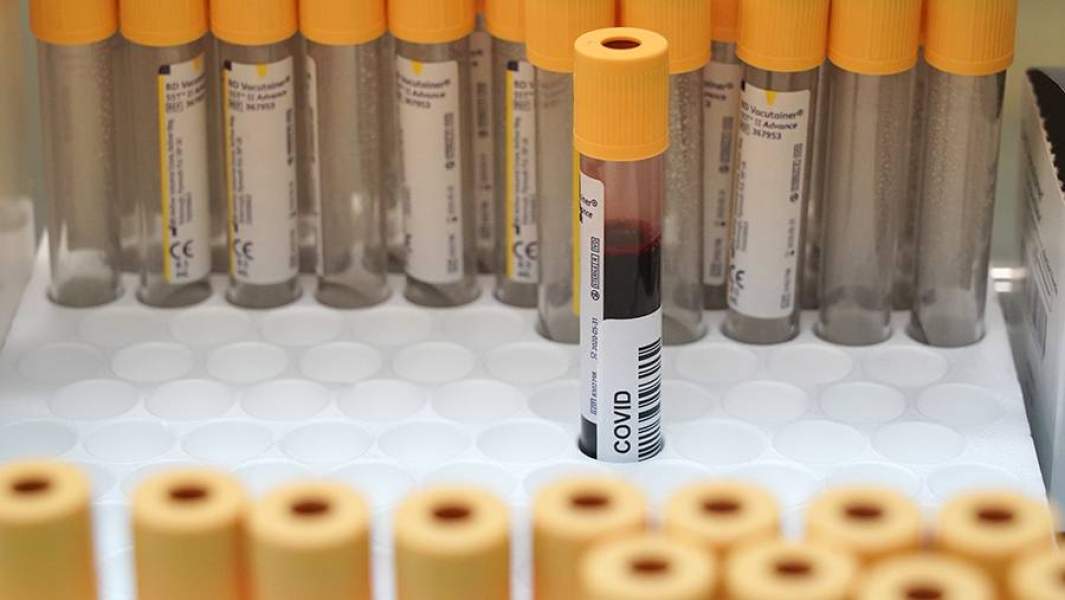 Забор крови на антитела