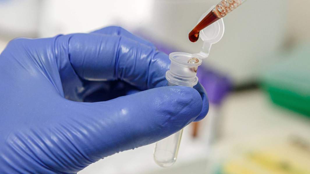 анализ крови в лаборатории