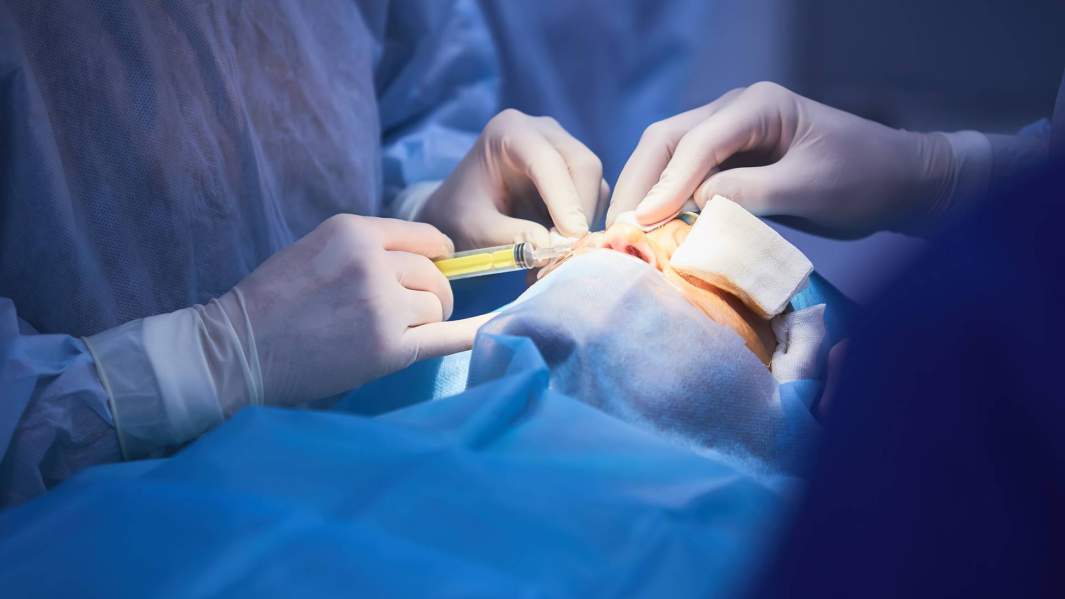 ринопластика