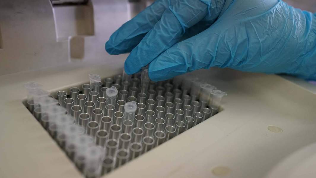 Штамм не страшно: Роспотребнадзор не увидел динамики в распространении AY.4.2