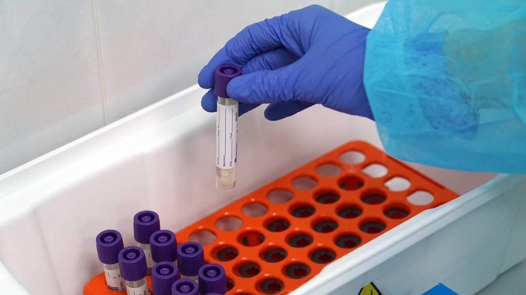 коронавирус