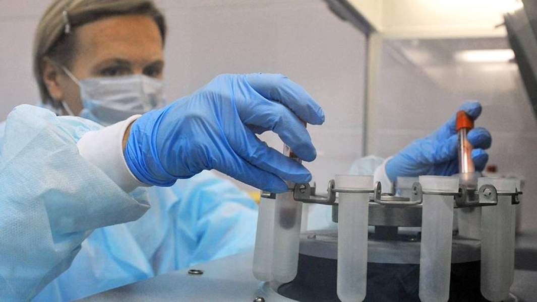 Лаборант иммунологического отдела Центра по профилактике и борьбе со СПИДом