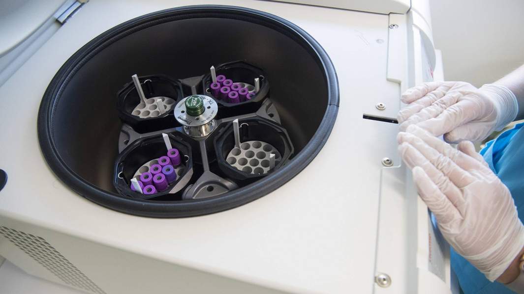 Компонентный анализ: в РФ создали тест на активность антител к SARS-CoV-2