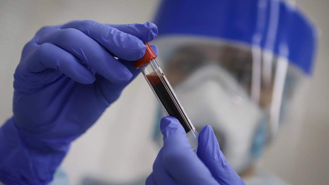 Компонентный анализ: в РФ создали тест на активность антител к SARS-CoV-2