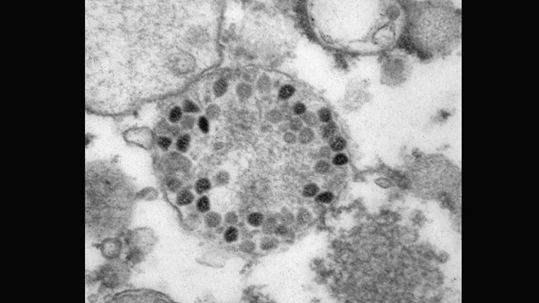 Фото вирусных частиц COVID-19 штамма «омикрон»