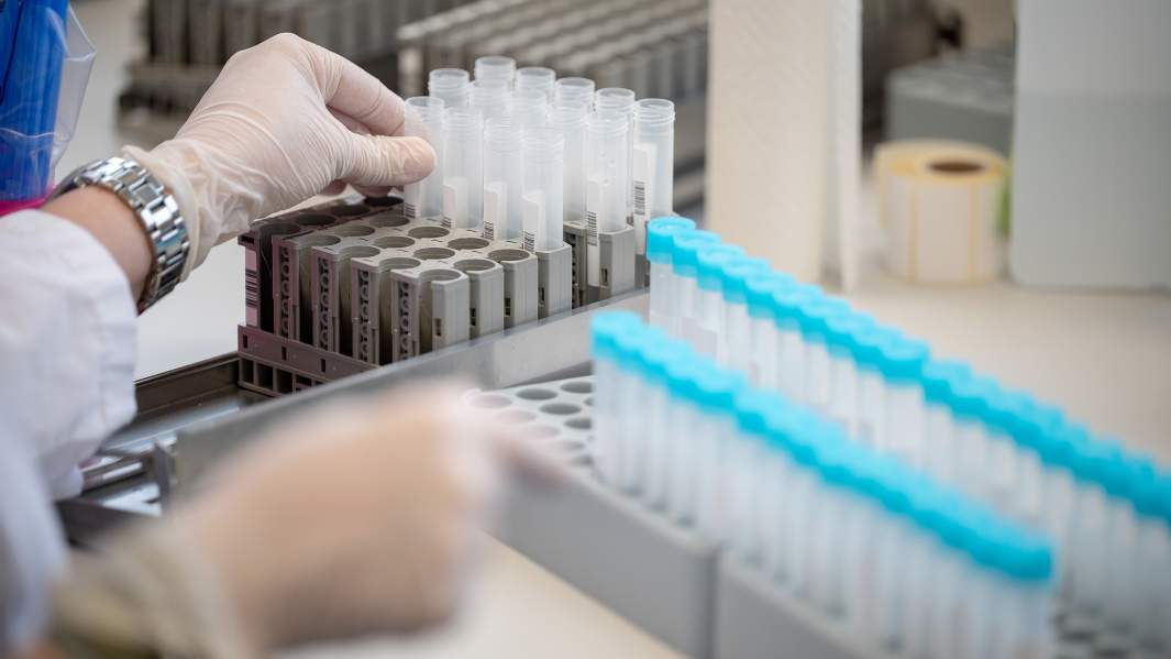 лаборатория вирус