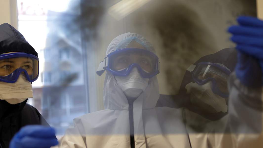 снимок легкие