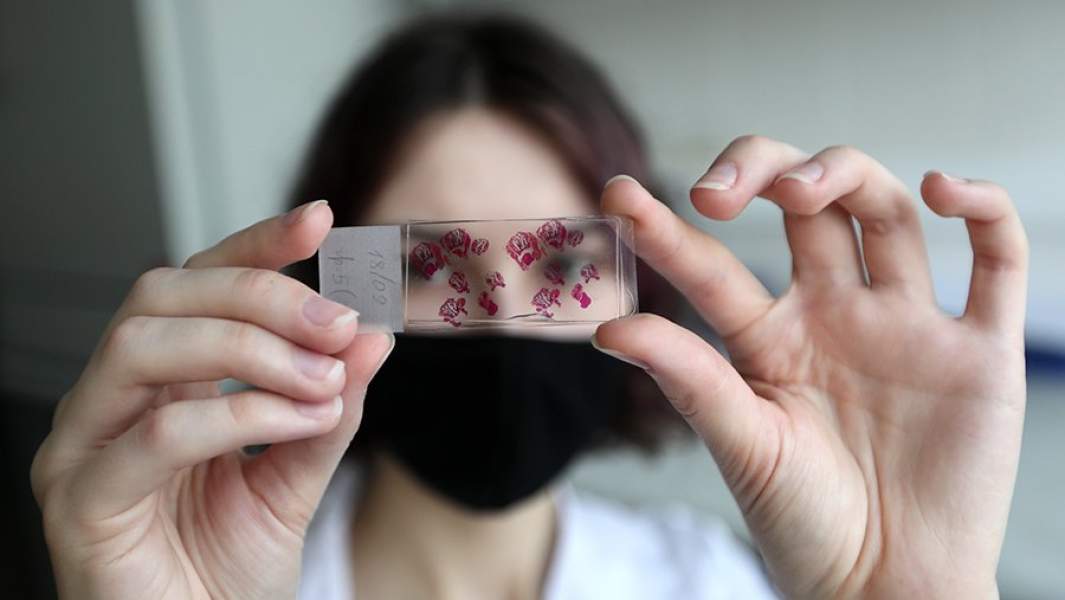 Сотрудница рассматривает клетки ткани легких мышей