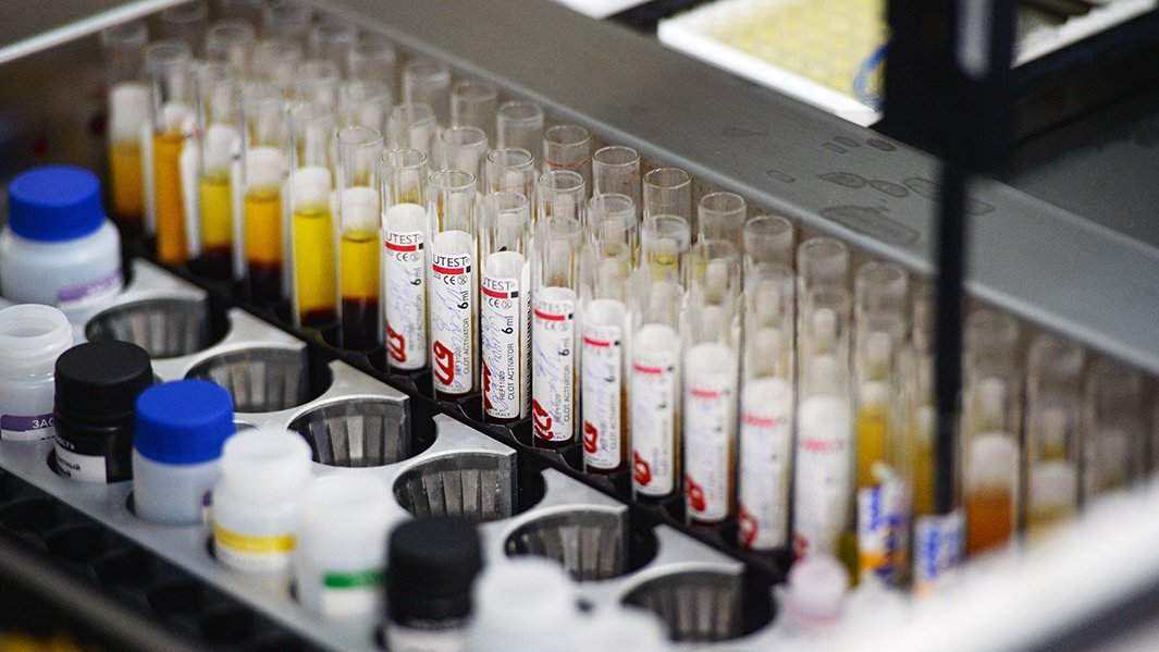 Лаборатория иммуноферментных исследований, где проходит исследование крови на гепатит