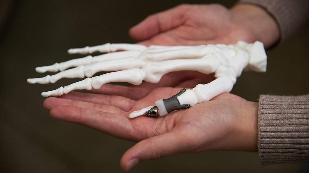 Эндопринт, аддитивные технологии