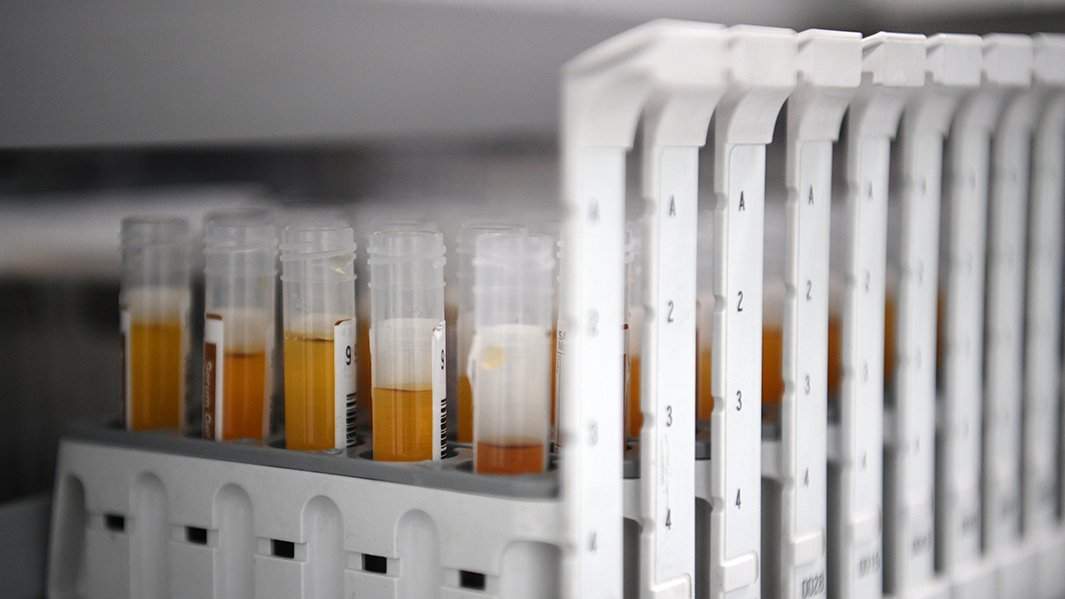 Образцы крови