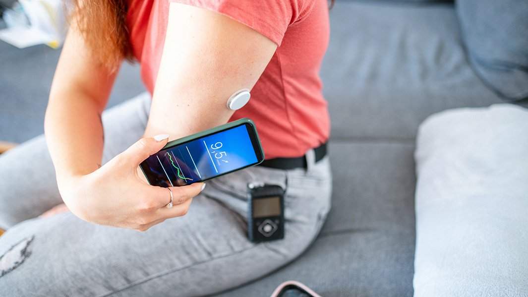 Девушка измеряет уровень глюкозы с помощью системы непрерывного мониторинга