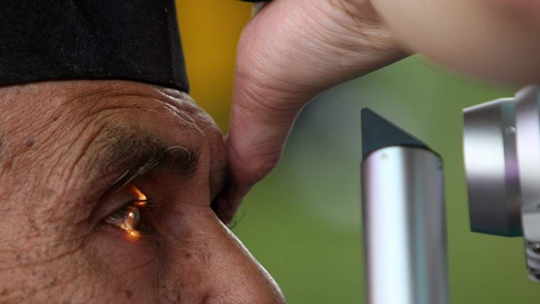 человеку проверяют сетчатку глаза