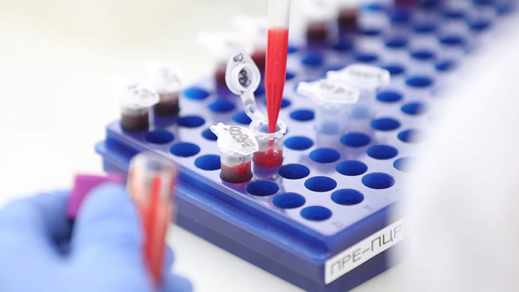 исследование