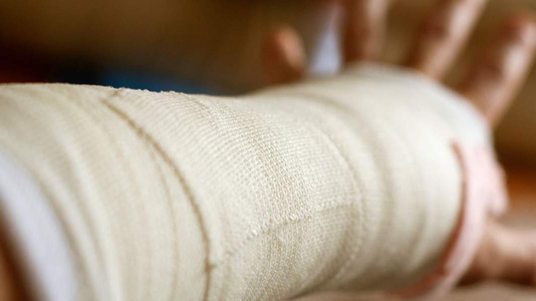 Рука в гипсе