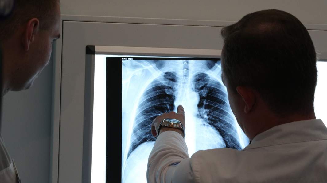 Снимок легких