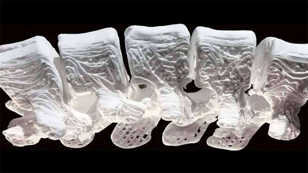 Имплант, напечатанный на 3d-принтере